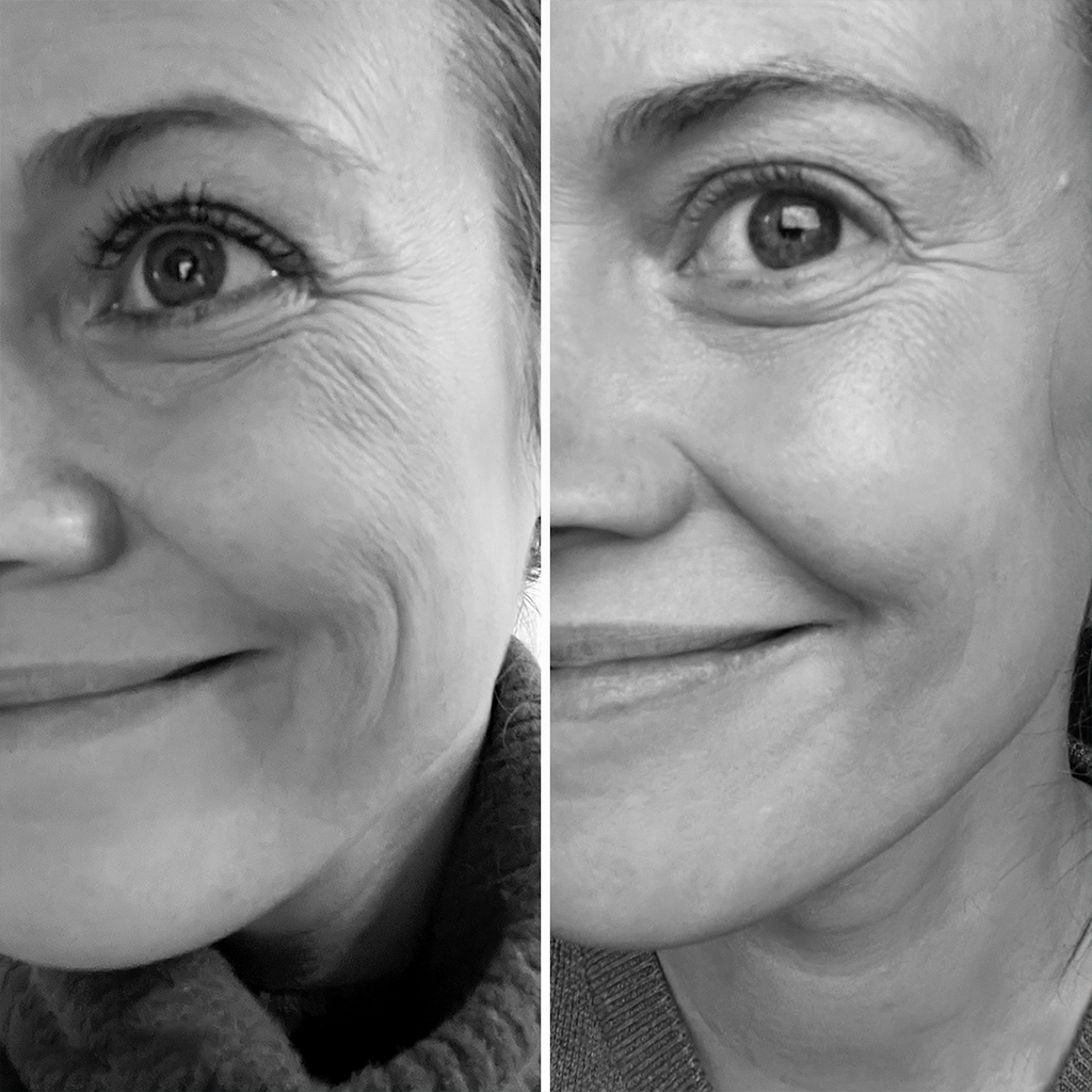 Melissa before/after